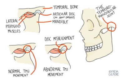 How can Osteopathy help manage TMJ issues?