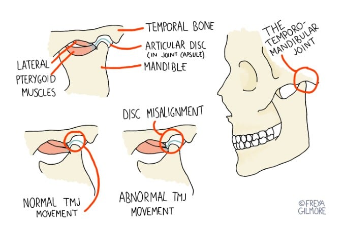 How can Osteopathy help manage TMJ issues?