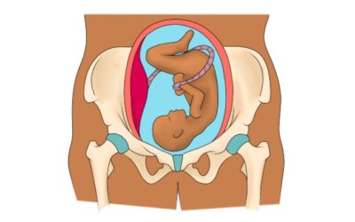 How can Osteopathy help with Symphysis Pubis Dysfunction (SPD)?